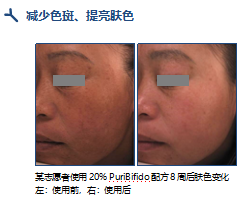 璞必达