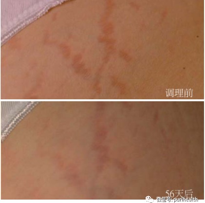 芸香苷纳米脂质体 来源资料图 6