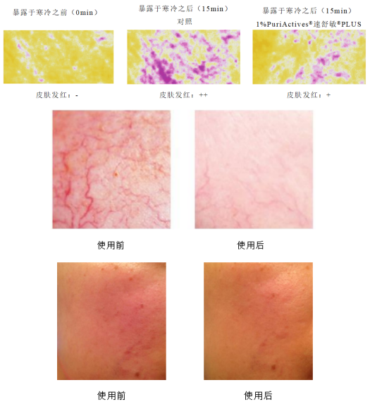 速舒敏® PLUS 来源资料图 6